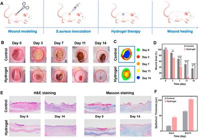 Polyhydroxy structure orchestrates the intrinsic antibacterial property of acrylamide hydrogel as a versatile wound-healing dressing